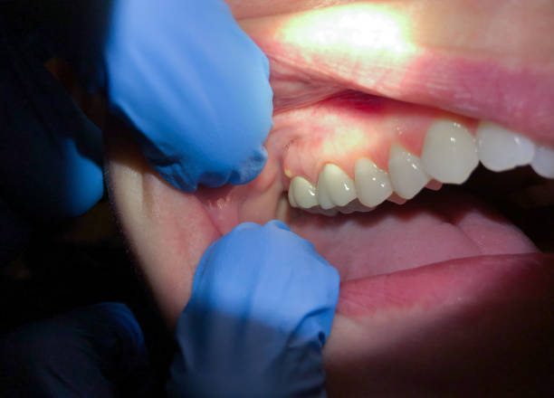 Best Weekend Emergency Dental Services in Lexington, MO